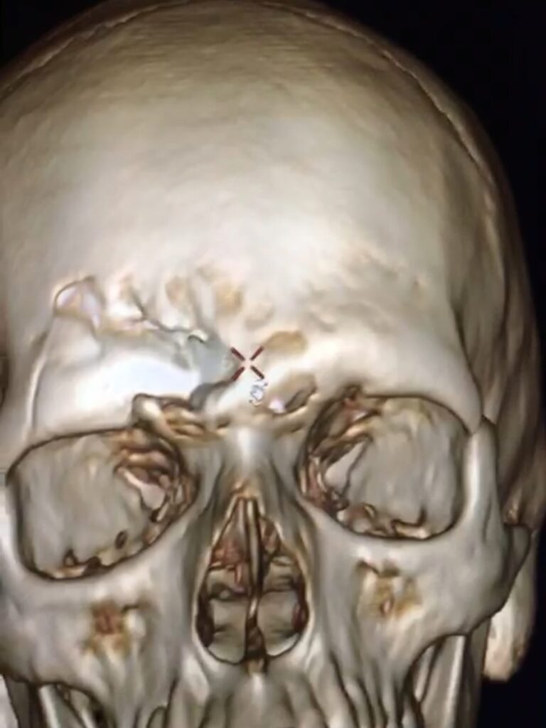 Instagram post from drcassiovinhadelli. This post is in position 4.