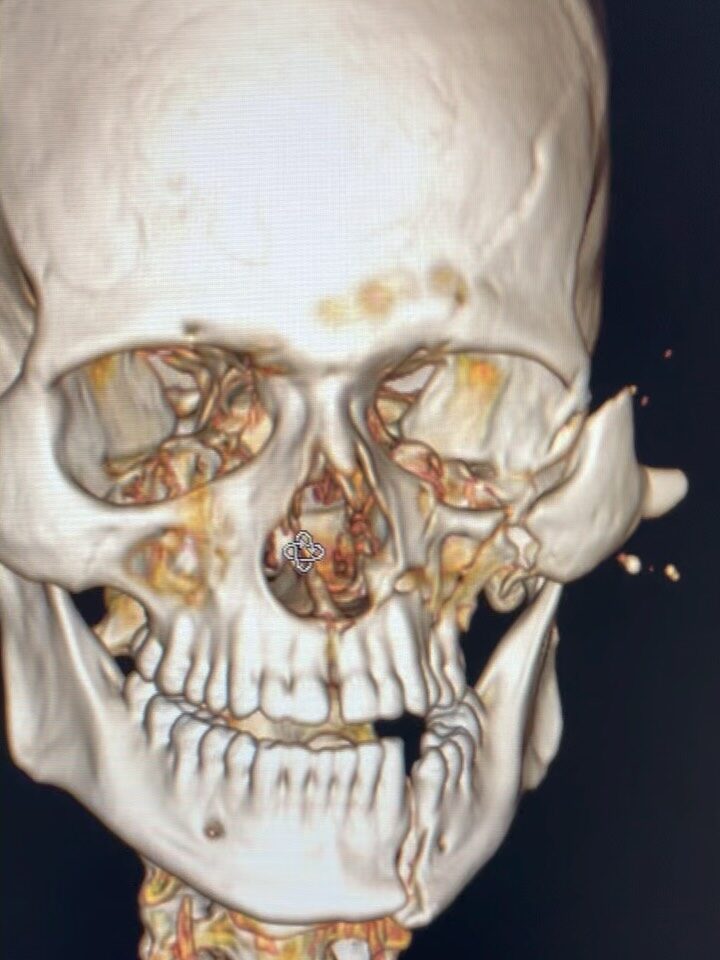 Instagram post from drcassiovinhadelli. This post is in position 4.