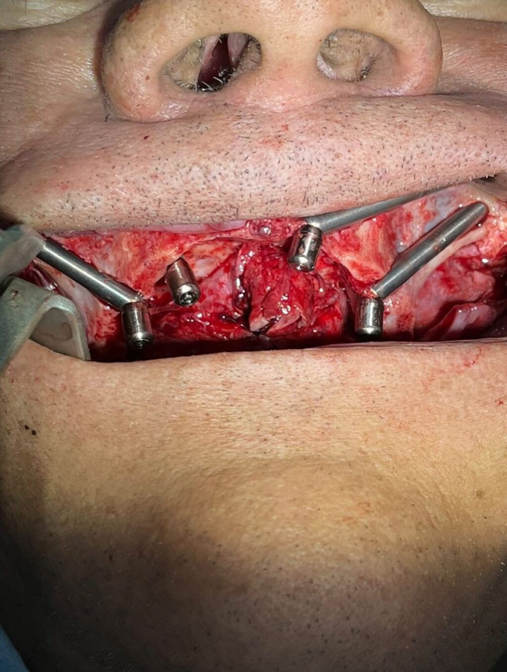 Instagram post from drcassiovinhadelli. This post is in position 6.