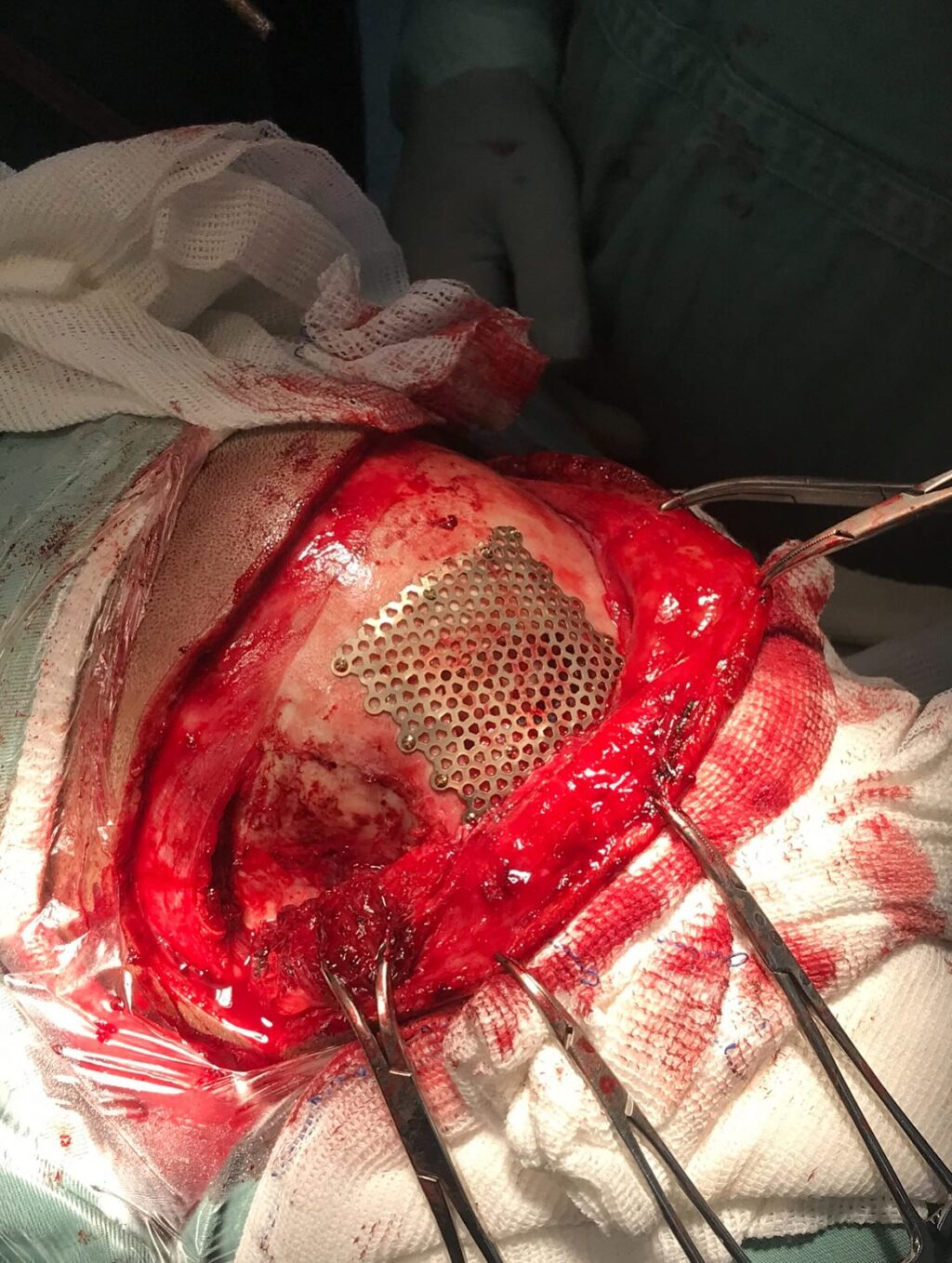 Instagram post from drcassiovinhadelli. This post is in position 2.