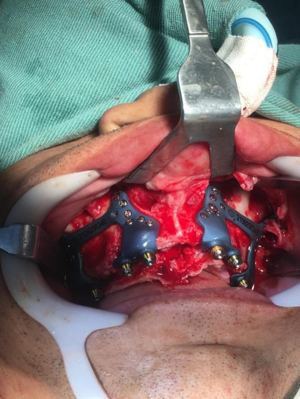 Instagram post from drcassiovinhadelli. This post is in position 1.